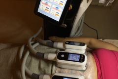 11-Cryitoec360-zsirfagyasztas-Diana-Szepsesgstudio-Dunaharaszti