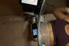 12-Cryitoec360-zsirfagyasztas-Diana-Szepsesgstudio-Dunaharaszti