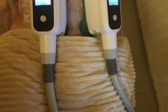 Diana-Szepsegstudio-dunaharaszti-zsirfagyasztas-cryotec-360-szalonkep-1