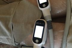 Diana-Szepsegstudio-dunaharaszti-zsirfagyasztas-cryotec-360-szalonkep-6