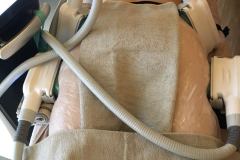 Diana-Szepsegstudio-dunaharaszti-zsirfagyasztas-cryotec-360-szalonkep-7