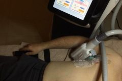 Zsirfagyasztas-Diana-Szepsegstudio-Dunaharaszti-11