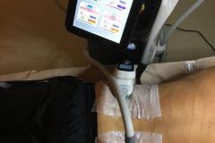 Zsirfagyasztas-Diana-Szepsegstudio-Dunaharaszti-12