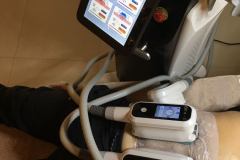 Zsirfagyasztas-Diana-Szepsegstudio-Dunaharaszti-13