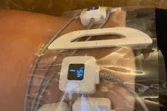 16-Monoshape-testkezeles-Diana-Szepsegstudio-Dnaharaszti