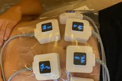 17-Monoshape-testkezeles-Diana-Szepsegstudio-Dnaharaszti