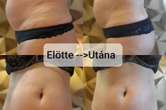 Borfeszesites-elotte-utana