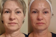 powershape2-kezeles-Diana-Szepsegstudio-Dunaharaszti-40