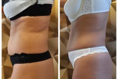 powershape2-kezeles-Diana-Szepsegstudio-Dunaharaszti-52