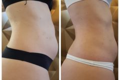 powershape2-kezeles-Diana-Szepsegstudio-Dunaharaszti-56