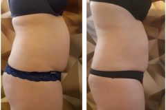 powershape2-kezeles-Diana-Szepsegstudio-Dunaharaszti-59