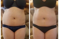 powershape2-kezeles-Diana-Szepsegstudio-Dunaharaszti-60