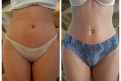 powershape2-kezeles-Diana-Szepsegstudio-Dunaharaszti-71