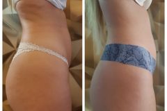 powershape2-kezeles-Diana-Szepsegstudio-Dunaharaszti-72