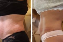 powershape2-kezeles-Diana-Szepsegstudio-Dunaharaszti-76