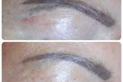 11-tetovalas-eltavolitas-Diana-Szepsegstudio-Dunaharaszti