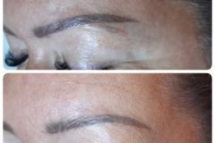 12-tetovalas-eltavolitas-Diana-Szepsegstudio-Dunaharaszti