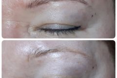 13-tetovalas-eltavolitas-Diana-Szepsegstudio-Dunaharaszti