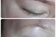 14-tetovalas-eltavolitas-Diana-Szepsegstudio-Dunaharaszti