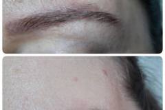 17-tetovalas-eltavolitas-Diana-Szepsegstudio-Dunaharaszti